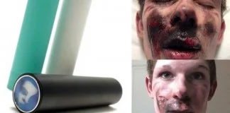 Canadian teen injured after Chinese made e-cigarette exploded to his face